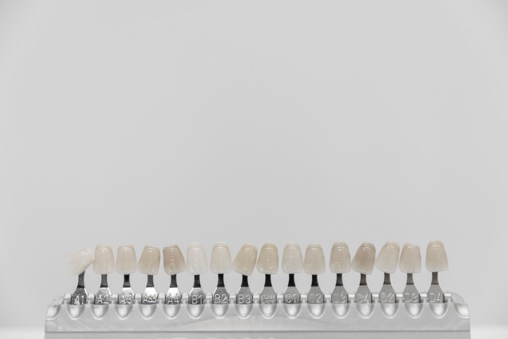 Dental shade guide for porcelain veneers. A tool reflecting the history of porcelain veneers and modern dentistry's precision in tooth color matching.
