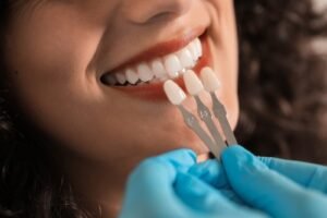 Long-Lasting Porcelain Veneers