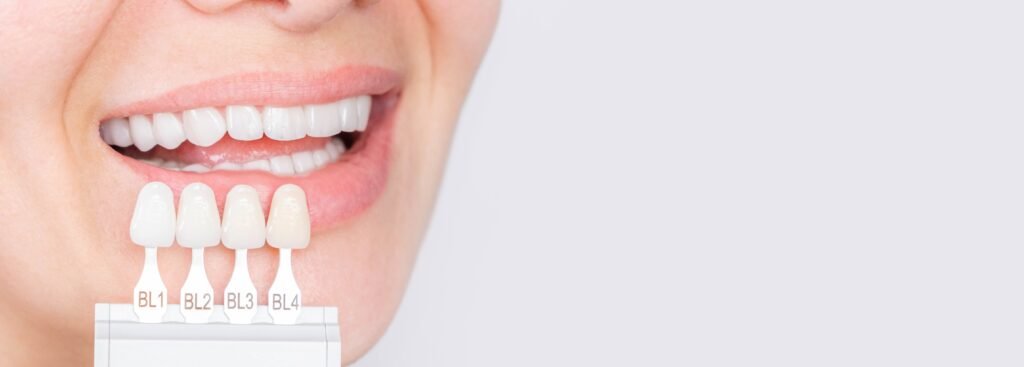Porcelain Veneers in Beverly Hills
