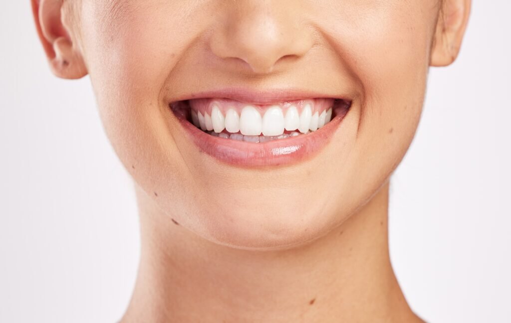 Hollywood teeth whitening